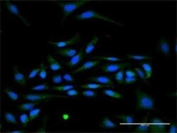 IFN-alpha I/IFNA17 Antibody, Novus Biologicals 0.1 mg | Buy Online | Novus Biologicals | Fisher Scientific