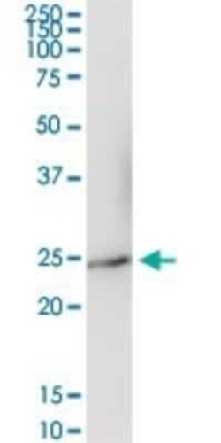 IFN-alpha I/IFNA17 Antibody, Novus Biologicals 0.1 mg | Buy Online | Novus Biologicals | Fisher Scientific