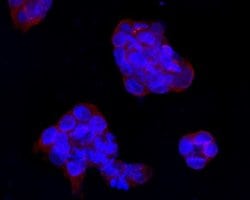 IFN-alpha/beta R1 Antibody (A5-A3), Novus Biologicals 100 &mu;l; Unconjugated:Antibodies,