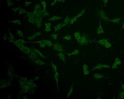 IFN-alpha/beta R1 Antibody (A5-A3), Novus Biologicals 100 &mu;l; Unconjugated:Antibodies,