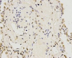 IFN-alpha/beta R1 Antibody (A5-A3), Novus Biologicals 100 &mu;l; Unconjugated:Antibodies,