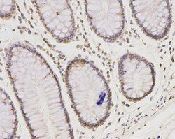 IFN-alpha/beta R1 Antibody (A5-A3), Novus Biologicals 100 &mu;l; Unconjugated:Antibodies,