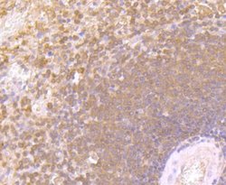 IFN-gamma Antibody (JM10-10), Novus Biologicals 100&mu;L:Antibodies, Monoclonal