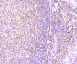 IFN-gamma Antibody (JM10-10), Novus Biologicals 100&mu;L:Antibodies, Monoclonal