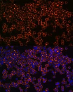 IFN-gamma R1/CD119 Rabbit anti-Human, Mouse, Rat, Clone: 2B9Q1, Novus Biologicals