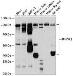 IFN-gamma R1/CD119 Rabbit anti-Human, Mouse, Rat, Clone: 2B9Q1, Novus Biologicals