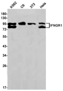 IFN-gamma R1/CD119 Rabbit anti-Human, Clone: S08-9H9, Novus Biologicals:Antibodies:Primary