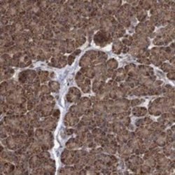 IFRD1 Rabbit anti-Human, Polyclonal, Novus Biologicals:Antibodies:Primary