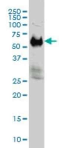 IFRD2 Antibody (1A4-1G1), Novus Biologicals 0.1 mg | Buy Online | Novus Biologicals | Fisher Scientific