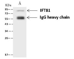 IFT81 Antibody, Novus Biologicals 100 &mu;g, Unconjugated:Antibodies, Polyclonal