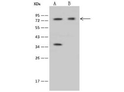 IFT81 Antibody, Novus Biologicals 100 &mu;g, Unconjugated:Antibodies, Polyclonal