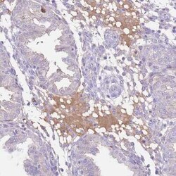 IGF-I/IGF-1 Antibody, Novus Biologicals 0.1 mL, Unconjugated:Antibodies,