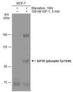 IGF-I R/IGF1R, p Tyr1316 Antibody, Novus Biologicals 100 &mu;g; Unconjugated:Antibodies,