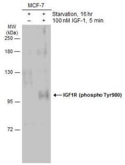 IGF-I R/IGF1R, p Tyr950 Antibody, Novus Biologicals 100 &mu;g | Buy Online | Novus Biologicals | Fisher Scientific