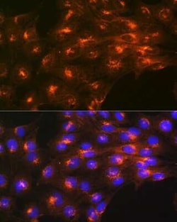 IGF-II R/IGF2R Rabbit anti-Human, Mouse, Rat, Clone: 4J4A3, Novus Biologicals 100 &mu;g | Buy Online | Novus Biologicals | Fisher Scientific