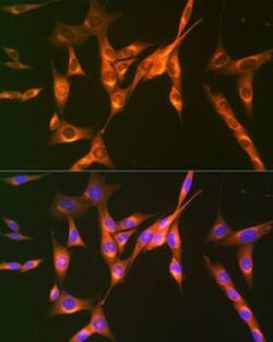 IGF-II R/IGF2R Rabbit anti-Human, Mouse, Rat, Clone: 4J4A3, Novus Biologicals 100 &mu;g | Buy Online | Novus Biologicals | Fisher Scientific