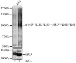 IGF1R/Insulin R Rabbit anti-Human, Mouse, Rat, Polyclonal, Novus Biologicals