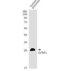 IGFBP-1 Rabbit anti-Human, Clone: S06-6J8, Novus Biologicals 100 &mu;g;