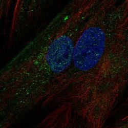 IGFBP-5 Antibody, Novus Biologicals:Antibodies:Primary Antibodies
