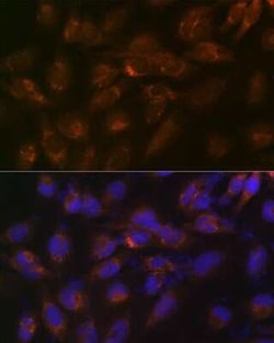 IGFBP-rp1/IGFBP-7 Rabbit anti-Human, Mouse, Rat, Clone: 8M10Q9, Novus Biologicals