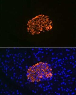 IGFBP-rp1/IGFBP-7 Rabbit anti-Human, Mouse, Rat, Clone: 8M10Q9, Novus Biologicals