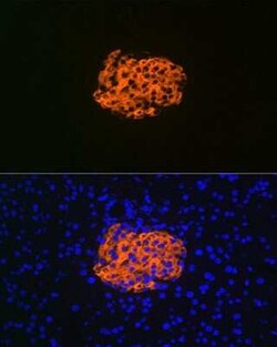 IGFBP-rp1/IGFBP-7 Rabbit anti-Human, Mouse, Rat, Clone: 8M10Q9, Novus Biologicals