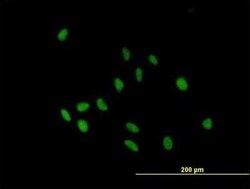 Novus Biologicals IgA2 Antibody, Novus Biologicals 50 &mu;g | Buy Online | Novus Biologicals&trade; | Fisher Scientific