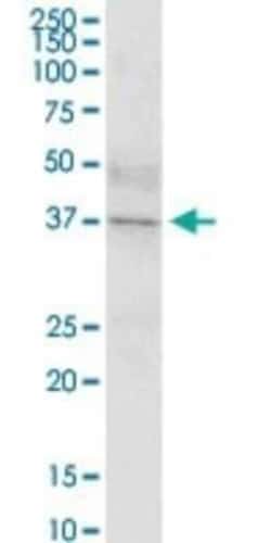 IGHD Antibody, Novus Biologicals 0.05 mg | Buy Online | Novus Biologicals | Fisher Scientific