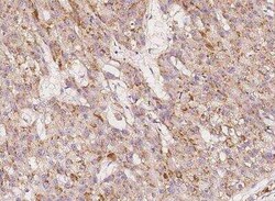 IGHMBP2 Antibody, Novus Biologicals 100 &mu;g | Buy Online | Novus Biologicals | Fisher Scientific