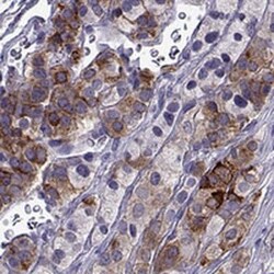 IGSF1 Antibody, Novus Biologicals:Antibodies:Primary Antibodies