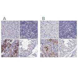 IGSF1 Antibody, Novus Biologicals:Antibodies:Primary Antibodies