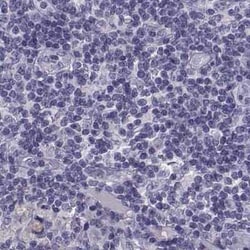 IGSF1 Antibody, Novus Biologicals:Antibodies:Primary Antibodies
