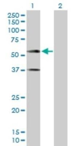IGSF4A/SynCAM1/CADM1 Antibody, Novus Biologicals 0.1 mg | Buy Online | Novus Biologicals | Fisher Scientific