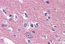 IGSF4D/SynCAM2/CADM2 Antibody, Novus Biologicals 50 &mu;g; Unconjugated:Antibodies,