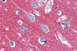 IGSF4D/SynCAM2/CADM2 Antibody, Novus Biologicals 50 μg; Unconjugated:Antibodies,