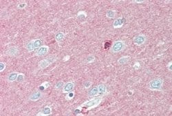 IGSF4D/SynCAM2/CADM2 Antibody, Novus Biologicals 50 &mu;g | Buy Online | Novus Biologicals | Fisher Scientific