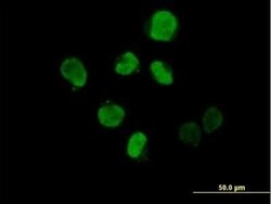 IHPK2 Antibody, Novus Biologicals 0.05 mg | Buy Online | Novus Biologicals | Fisher Scientific
