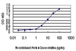 IKBKAP Antibody (6G9), Novus Biologicals 0.1 mg | Buy Online | Novus Biologicals | Fisher Scientific
