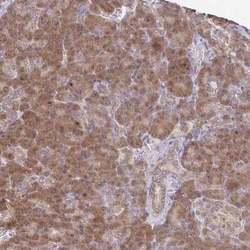 IKBKAP Antibody, Novus Biologicals 25 &mu;L, Unconjugated:Antibodies, Polyclonal