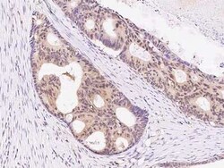 IKK alpha Antibody, Novus Biologicals 100 &mu;g, Unconjugated:Anticorps,
