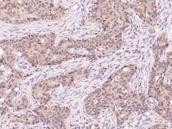 IKK alpha Antibody, Novus Biologicals 100 &mu;g, Unconjugated:Anticorps,