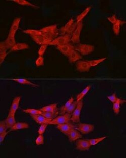 IKK beta Rabbit anti-Human, Mouse, Rat, Clone: 7G8J8, Novus Biologicals 20 &mu;g | Buy Online | Novus Biologicals | Fisher Scientific