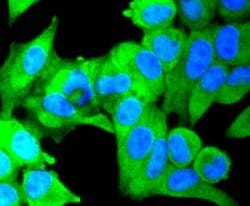 IKK beta Antibody (SN63-02), Novus Biologicals 100&mu;L:Antibodies, Monoclonal