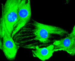 IKK beta Antibody (SN63-02), Novus Biologicals 100&mu;L:Antibodies, Monoclonal