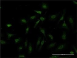 IKK beta Antibody (3C12), Novus Biologicals 0.1 mg | Buy Online | Novus Biologicals | Fisher Scientific