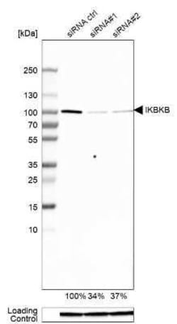 IKK beta Antibody, Novus Biologicals 25 &mu;L; Unconjugated:Antibodies,