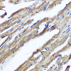 IKK epsilon/IKBKE Rabbit anti-Human, Mouse, Rat, Clone: 5N4J8, Novus Biologicals