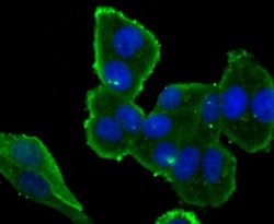 IKK epsilon/IKBKE Rabbit anti-Human, Clone: JU06-72, Novus Biologicals