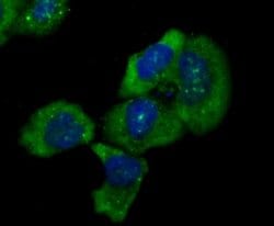 IKK epsilon/IKBKE Rabbit anti-Human, Clone: JU06-72, Novus Biologicals