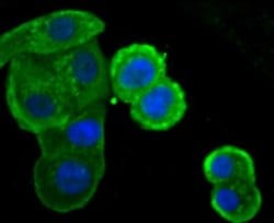 IKK epsilon/IKBKE Rabbit anti-Human, Clone: JU06-72, Novus Biologicals